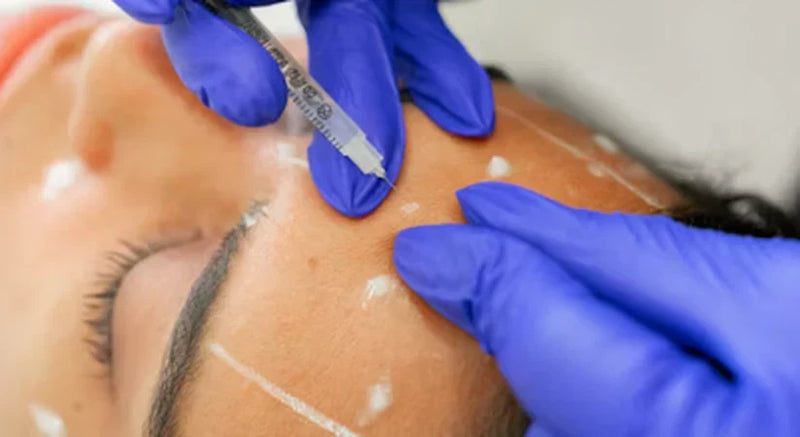 Laser Mask After Botox or Hyaluronic Acid Injections: Safe Use Guide