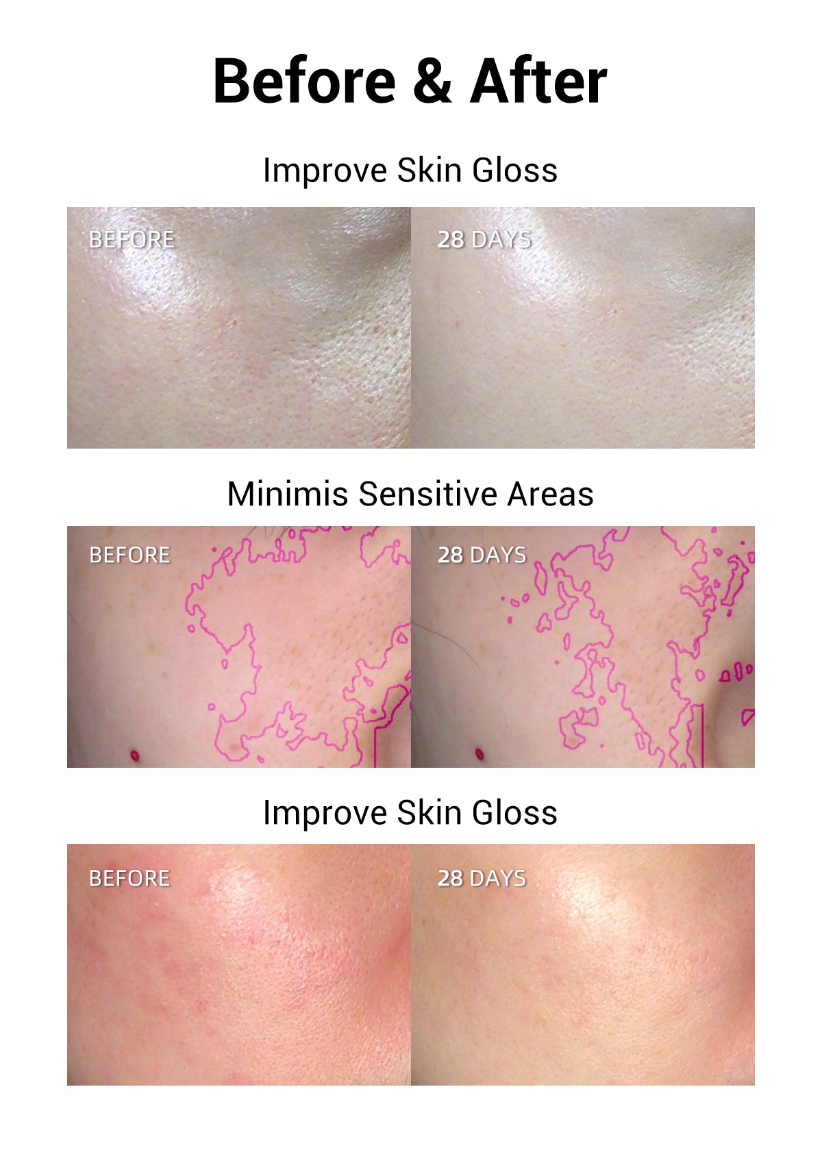 Before and after comparison of skin showing enhanced gloss and minimized sensitive areas following 28 days of treatment.