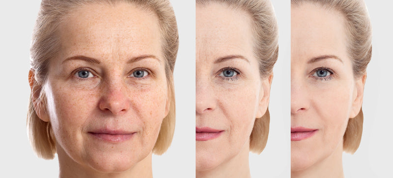 LED vs Laser for Skin Rejuvenation: What's the Difference?
