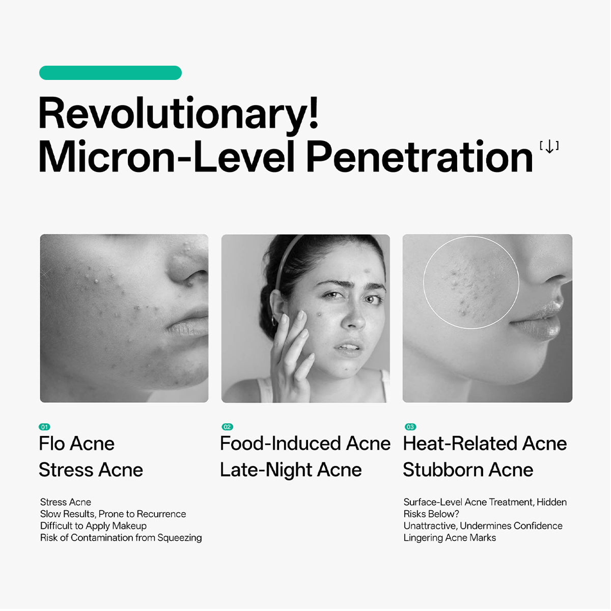 JOVS Microneedle-Infused Acne Patch