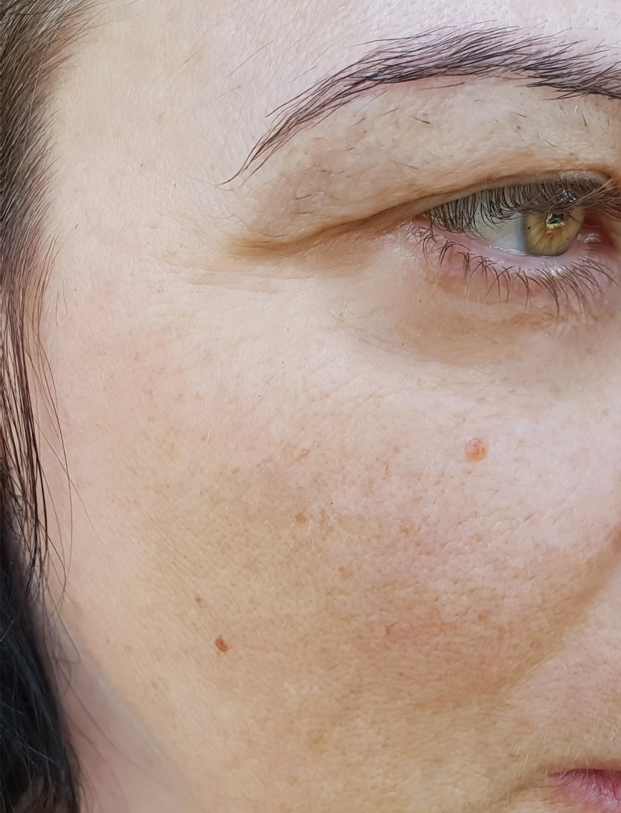 Week 2