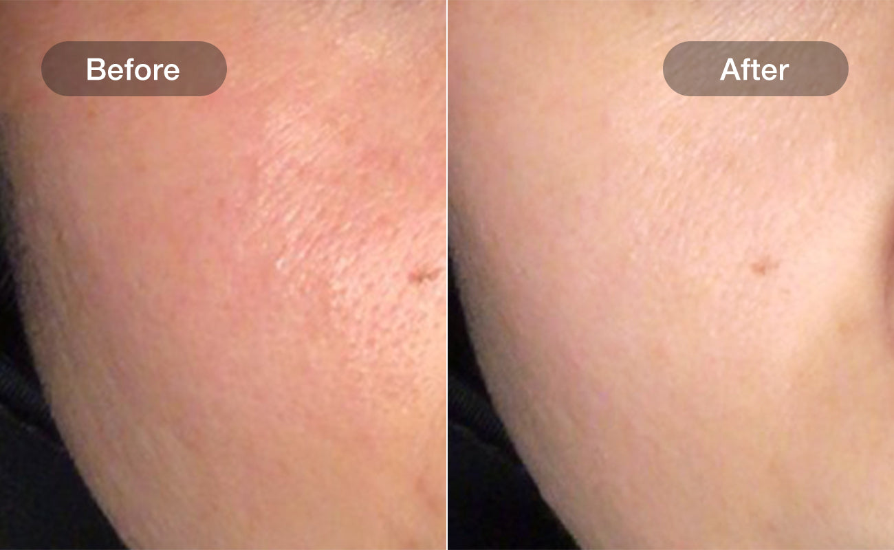 Skin Firming and Radiance results