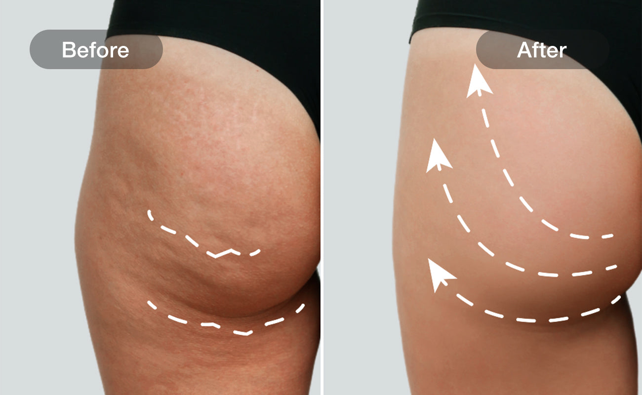 Smooth and Firm results