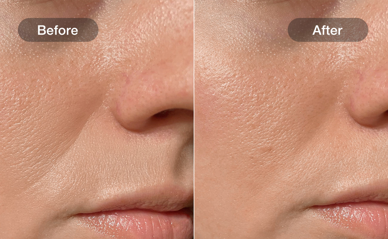 Wrinkle Reduction results