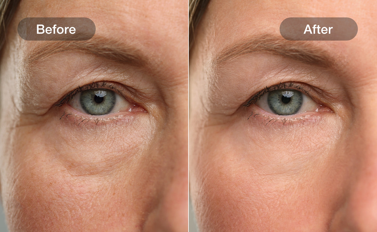 Skin Firming results