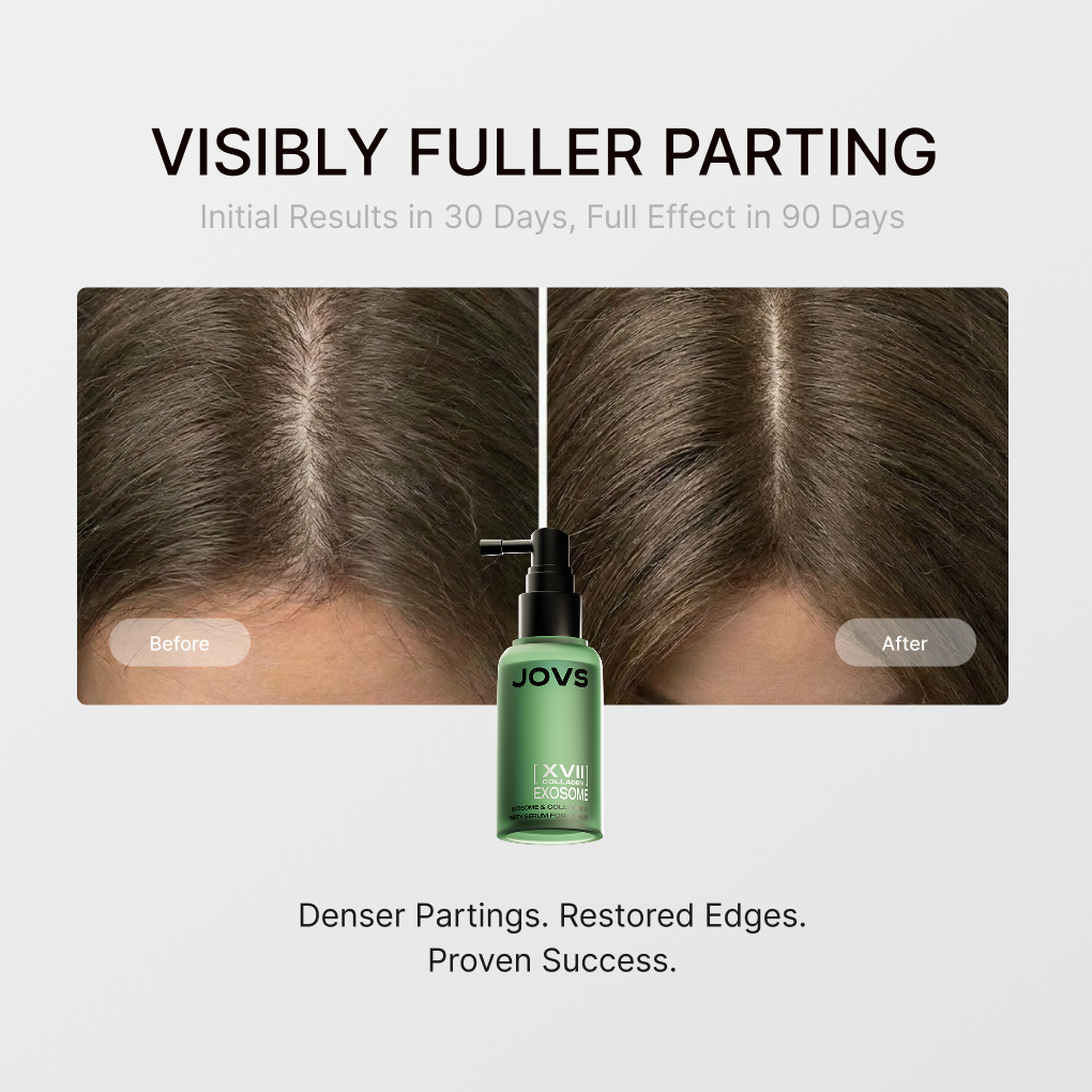 JOVS Exosome & Collagen 17 Hair Density Serum JOVS Exosome & Collagen 17 Hair Density Serum