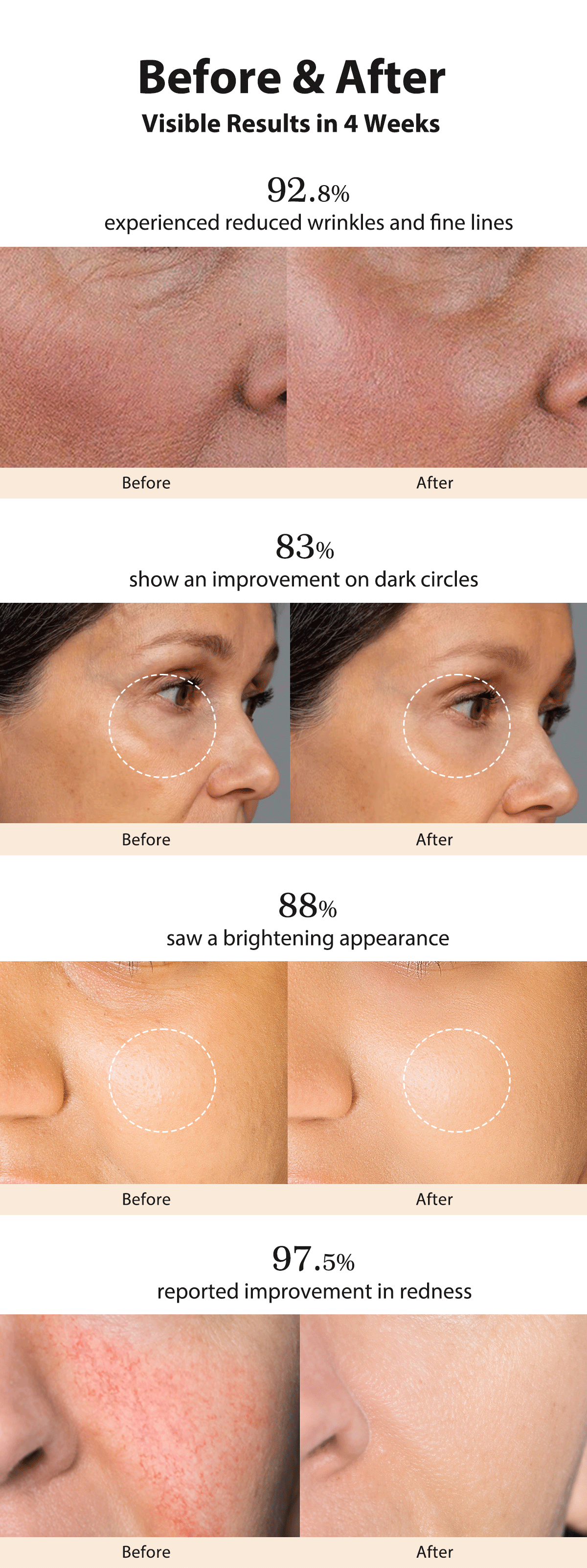 Before and after skincare transformation showing 92.8% reduced wrinkles, 83% improvement in dark circles, 88% skin brightening, and 97.5% reduction in redness.