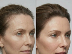 Scalp Aging