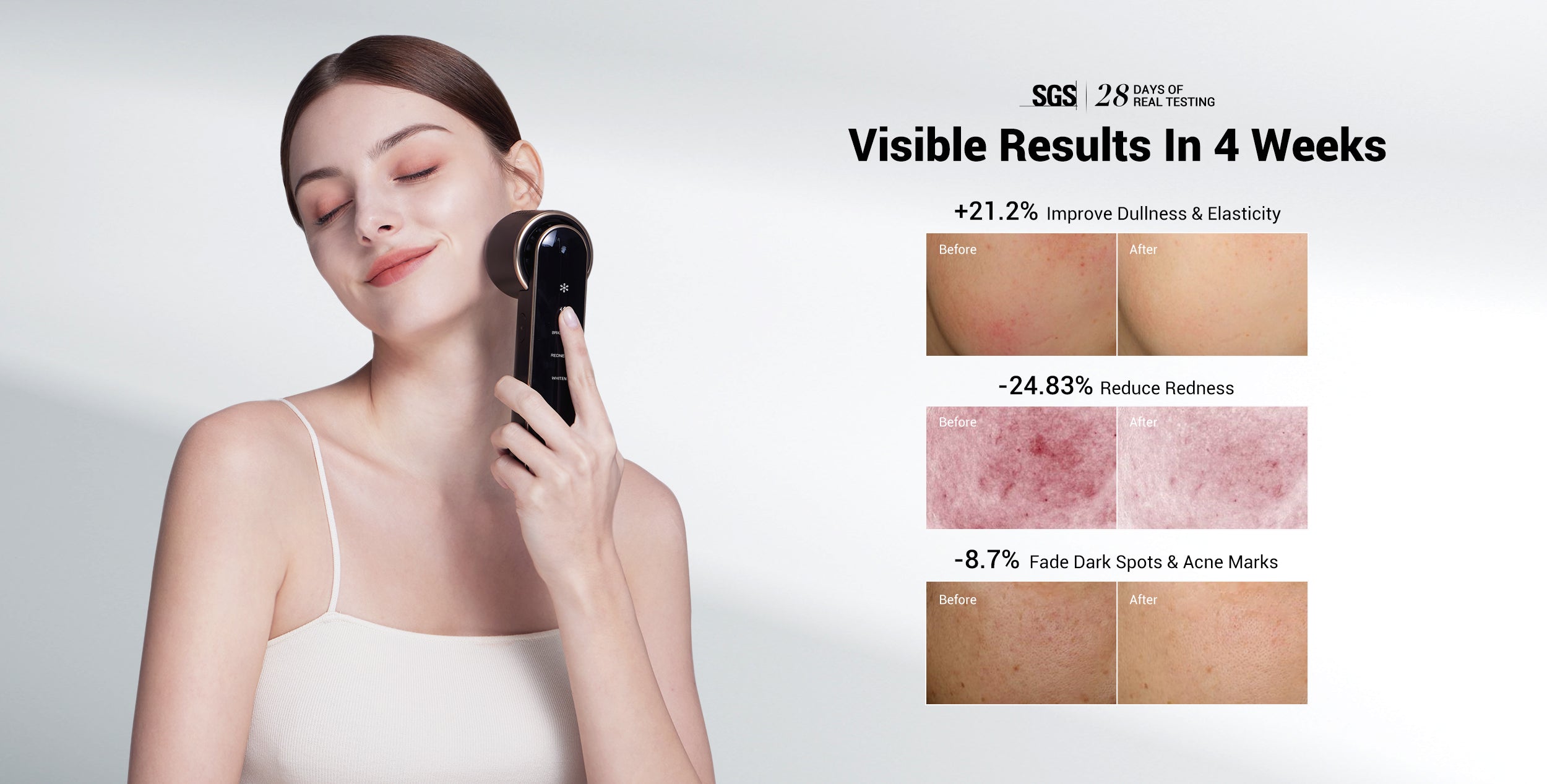 JOVS Blacken DPL Photorejuvenation Device results after 4 weeks showing improved skin elasticity and reduced redness and dark spots for a more radiant complexion.