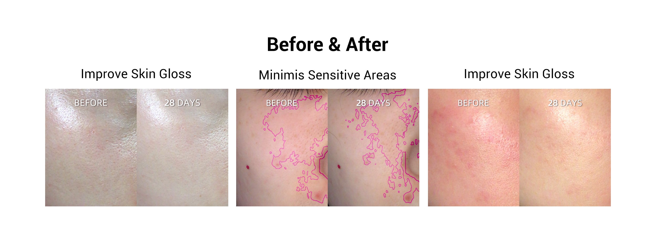 Before and after images showing improvement in skin gloss and reduction of sensitive areas after 28 days of LED light treatment.