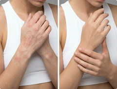 Hand Fatigue Relief