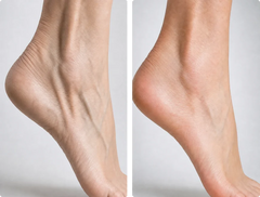 Poor Circulation
