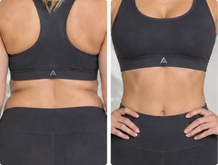 Abdominal Sculpting
