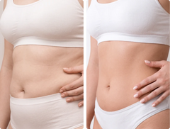Waist Sculpting